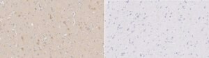 Anti-Choline Transporter Antibody from rabbit, purified by affinity chromatography