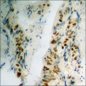 Anti-phospho-p53 (pSer392) antibody produced in rabbit affinity isolated antibody