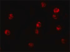 Anti-JMJD3 antibody produced in rabbit affinity isolated antibody