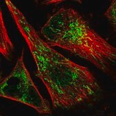 Anti-IMPA1 antibody produced in rabbit Prestige Antibodies® Powered by Atlas Antibodies, affinity isolated antibody, buffered aqueous glycerol solution