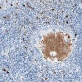 Anti-IL6ST antibody produced in rabbit Prestige Antibodies® Powered by Atlas Antibodies, affinity isolated antibody, buffered aqueous glycerol solution