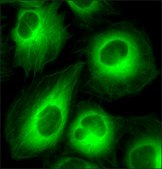 U2OS LMNB1-TUBA1B-ACTB