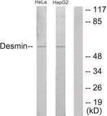 Anti-Desmin antibody produced in rabbit affinity isolated antibody