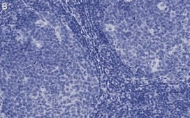 Anti-CD81 Antibody, clone 1C23 ZooMAb® Rabbit Monoclonal recombinant, expressed in HEK 293 cells