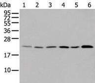 Anti-DUSP3 affinity isolated antibody