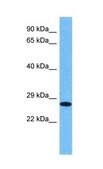 Anti-HMGB1 affinity isolated antibody