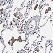 抗-TRAF6 兔抗 Prestige Antibodies® Powered by Atlas Antibodies, affinity isolated antibody, buffered aqueous glycerol solution, Ab1