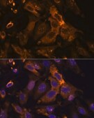 Anti-TIMP2 antibody produced in rabbit