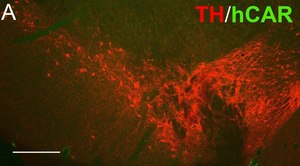 Anti-CAR Antibody, clone RmcB clone RmcB, Upstate®, from mouse