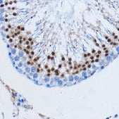 Anti-DDIT3/CHOP antibody produced in rabbit