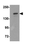 Anti-ROCK2 Antibody from rabbit, purified by affinity chromatography