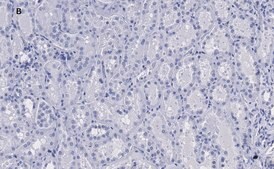 Anti-KRas Antibody, clone 2J13, ZooMAb® Rabbit Monoclonal recombinant, expressed in HEK 293 cells