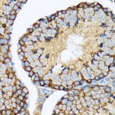 Anti-USP9X antibody produced in rabbit