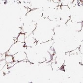 抗-VEGFA 兔抗 Prestige Antibodies® Powered by Atlas Antibodies, affinity isolated antibody