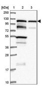 Anti-TBC1D2B antibody produced in rabbit Prestige Antibodies® Powered by Atlas Antibodies, affinity isolated antibody, buffered aqueous glycerol solution
