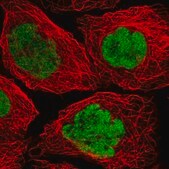 Anti-p53 antibody produced in rabbit Prestige Antibodies® Powered by Atlas Antibodies, affinity isolated antibody