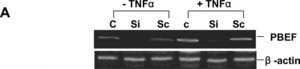 抗 β-肌动蛋白抗体，小鼠单克隆 clone AC-15, purified from hybridoma cell culture