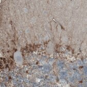 Monoclonal Anti-PHGDH antibody produced in mouse Prestige Antibodies® Powered by Atlas Antibodies, clone CL0555, purified immunoglobulin, buffered aqueous glycerol solution