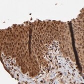 Anti-CASP1 antibody produced in rabbit Prestige Antibodies® Powered by Atlas Antibodies, affinity isolated antibody, buffered aqueous glycerol solution