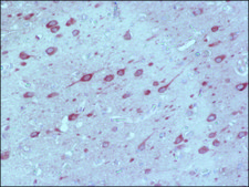 Anti-MAP2 (2a+2b) antibody, Mouse monoclonal ~2 mg/mL, clone AP-20, purified from hybridoma cell culture