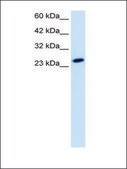 Anti-TBPL1 antibody produced in rabbit IgG fraction of antiserum