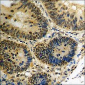 Anti-phospho-PKR (pThr258) antibody produced in rabbit affinity isolated antibody