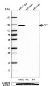 Anti-ACLY antibody produced in rabbit Prestige Antibodies® Powered by Atlas Antibodies, affinity isolated antibody, buffered aqueous glycerol solution