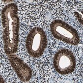 Anti-PGR antibody produced in rabbit Ab2, Prestige Antibodies® Powered by Atlas Antibodies, affinity isolated antibody, buffered aqueous glycerol solution