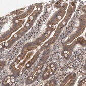 Anti-NECTIN1 antibody produced in rabbit Prestige Antibodies® Powered by Atlas Antibodies, affinity isolated antibody, buffered aqueous glycerol solution