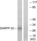 Anti-DARPP-32, N-Terminal antibody produced in rabbit affinity isolated antibody