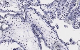 Anti-Integrin α-5 Antibody, clone 5E18 ZooMAb® Rabbit Monoclonal recombinant, expressed in HEK 293 cells