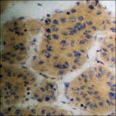 Anti-phospho-PAK4/5/6 (pSer474) antibody produced in rabbit affinity isolated antibody