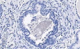 Anti-phospho-eIF-2α-Ser51 Antibody, clone 4N22 ZooMAb® Rabbit Monoclonal recombinant, expressed in HEK 293 cells