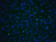 OSUMMER.10 Mouse NRAS-Mutant Melanoma Cell Line