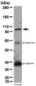 Anti-Integrin beta-3 Antibody from rabbit, purified by affinity chromatography