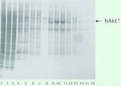 不含EDTA的cOmplete™ Mini蛋白酶抑制剂混合物 Tablets provided in EASYpacks