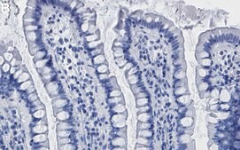Anti-PDK1 Antibody, clone 1E13 ZooMAb® Rabbit Monoclonal recombinant, expressed in HEK 293 cells