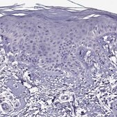 Anti-NKX3-1 Prestige Antibodies® Powered by Atlas Antibodies, affinity isolated antibody