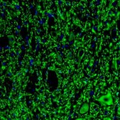 Anti-MAP2 antibody produced in rabbit Prestige Antibodies® Powered by Atlas Antibodies, affinity isolated antibody, buffered aqueous glycerol solution