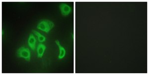 抗TNFA 兔抗 affinity isolated antibody
