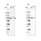 抗HSPA5 兔抗 Prestige Antibodies® Powered by Atlas Antibodies, affinity isolated antibody, buffered aqueous glycerol solution