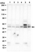 Anti-Oxytocin Receptor from rabbit, purified by affinity chromatography