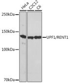 Anti-UPF1/RENT1 Antibody, clone 5D5C4, Rabbit Monoclonal
