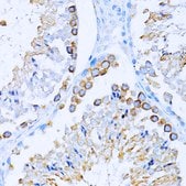Anti-CD63 antibody produced in rabbit