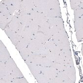 Monoclonal Anti-CDKL5 antibody produced in mouse Prestige Antibodies® Powered by Atlas Antibodies, clone CL4888, purified immunoglobulin, buffered aqueous glycerol solution