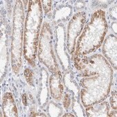 Anti-SGPL1 antibody produced in rabbit Prestige Antibodies® Powered by Atlas Antibodies, affinity isolated antibody, buffered aqueous glycerol solution