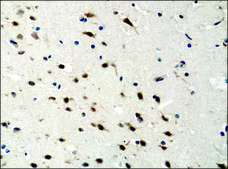 抗-ATG4B 兔抗 IgG fraction of antiserum, buffered aqueous solution