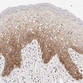 Anti-CXADR antibody produced in rabbit Prestige Antibodies® Powered by Atlas Antibodies, affinity isolated antibody, buffered aqueous glycerol solution