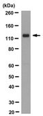 Anti-ROR2 Antibody, clone Nt 2535-2835 clone Nt2535-2835, from mouse