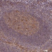 Anti-TIGAR antibody produced in rabbit Prestige Antibodies® Powered by Atlas Antibodies, affinity isolated antibody, buffered aqueous glycerol solution
